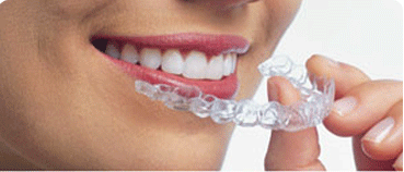 invisalign